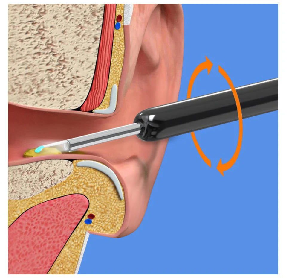 Ear Cleaner with Camera